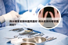 四川哪家皮肤科医院最好 四川皮肤科哪家医院好?