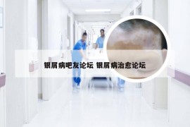 银屑病吧友论坛 银屑病治愈论坛