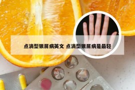 点滴型银屑病英文 点滴型银屑病是最轻