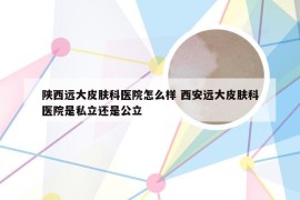 陕西远大皮肤科医院怎么样 西安远大皮肤科医院是私立还是公立