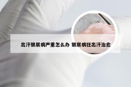 出汗银屑病严重怎么办 银屑病狂出汗治愈