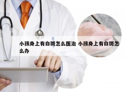 小孩身上有白斑怎么医治 小孩身上有白斑怎么办