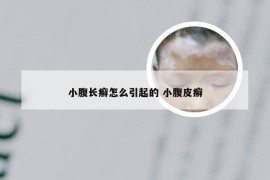 小腹长癣怎么引起的 小腹皮癣