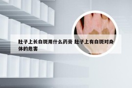 肚子上长白斑用什么药膏 肚子上有白斑对身体的危害