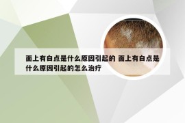 面上有白点是什么原因引起的 面上有白点是什么原因引起的怎么治疗