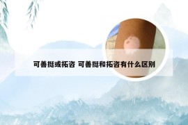 可善挺或拓咨 可善挺和拓咨有什么区别