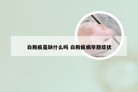 白殿疯是缺什么吗 白殿疯病早期症状