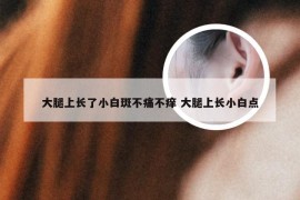 大腿上长了小白斑不痛不痒 大腿上长小白点