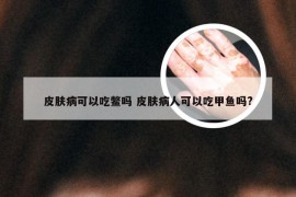 皮肤病可以吃鳖吗 皮肤病人可以吃甲鱼吗?