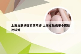 上海皮肤病哪家医院好 上海皮肤病哪个医院比较好