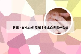 胳膊上有小白点 胳膊上有小白点是什么病