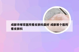 成都市哪家医院看皮肤科最好 成都那个医院看皮肤科