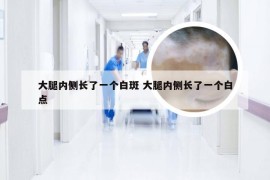 大腿内侧长了一个白斑 大腿内侧长了一个白点