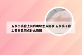 五岁小孩脸上有白斑块怎么回事 五岁孩子脸上有白色斑点什么原因