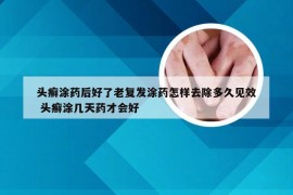 头癣涂药后好了老复发涂药怎样去除多久见效 头癣涂几天药才会好