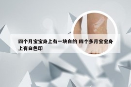 四个月宝宝身上有一块白的 四个多月宝宝身上有白色印