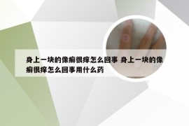 身上一块的像癣很痒怎么回事 身上一块的像癣很痒怎么回事用什么药