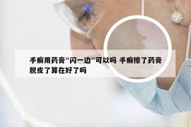 手癣用药膏"闪一边"可以吗 手癣擦了药膏脱皮了算在好了吗