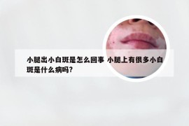 小腿出小白斑是怎么回事 小腿上有很多小白斑是什么病吗?