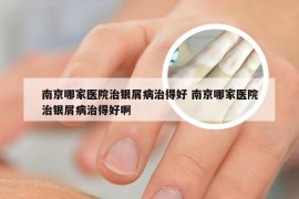 南京哪家医院治银屑病治得好 南京哪家医院治银屑病治得好啊