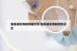 银屑病生物制剂排行榜 银屑病生物制剂性价比