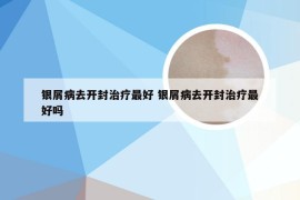 银屑病去开封治疗最好 银屑病去开封治疗最好吗