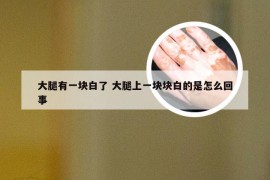 大腿有一块白了 大腿上一块块白的是怎么回事