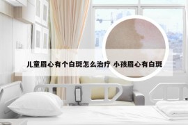 儿童眉心有个白斑怎么治疗 小孩眉心有白斑