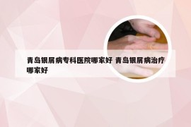 青岛银屑病专科医院哪家好 青岛银屑病治疗哪家好