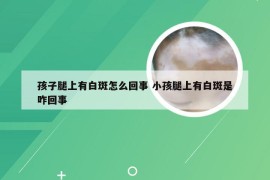 孩子腿上有白斑怎么回事 小孩腿上有白斑是咋回事