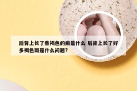 后背上长了些褐色的癣是什么 后背上长了好多褐色斑是什么问题?