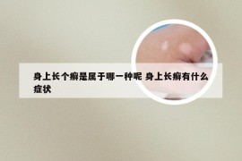 身上长个癣是属于哪一种呢 身上长癣有什么症状