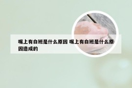 嘴上有白班是什么原因 嘴上有白班是什么原因造成的