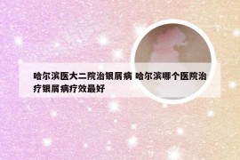 哈尔滨医大二院治银屑病 哈尔滨哪个医院治疗银屑病疗效最好