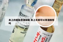 身上的癣能用酒抹嘛 身上长癣可以用酒精擦吗