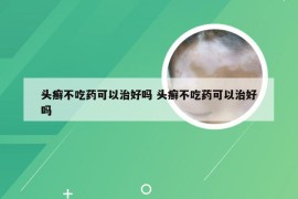 头癣不吃药可以治好吗 头癣不吃药可以治好吗