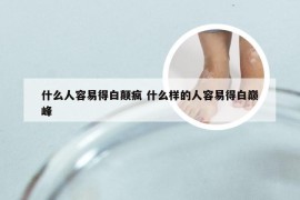 什么人容易得白颠疯 什么样的人容易得白巅峰