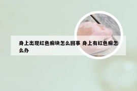 身上出现红色癣块怎么回事 身上有红色癣怎么办