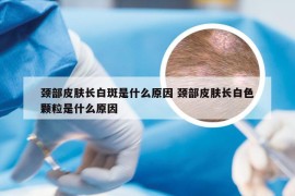 颈部皮肤长白斑是什么原因 颈部皮肤长白色颗粒是什么原因