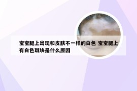 宝宝腿上出现和皮肤不一样的白色 宝宝腿上有白色斑块是什么原因