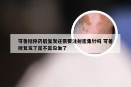 可善挺停药后复发还需要注射密集针吗 可善挺复发了是不是没治了