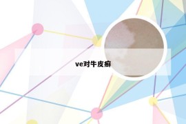 ve对牛皮癣