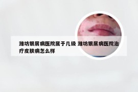 潍坊银屑病医院属于几级 潍坊银屑病医院治疗皮肤病怎么样