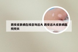 西安皮肤病在线咨询远大 西安远大皮肤病医院院长