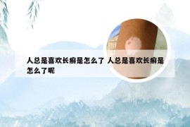 人总是喜欢长癣是怎么了 人总是喜欢长癣是怎么了呢