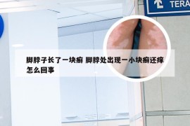 脚脖子长了一块癣 脚脖处出现一小块癣还痒怎么回事