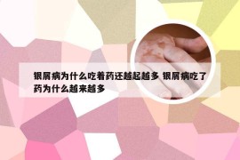 银屑病为什么吃着药还越起越多 银屑病吃了药为什么越来越多