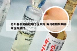 苏州看牛皮癣在哪个医院好 苏州看银屑病哪家医院最好