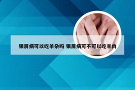 银屑病可以吃羊杂吗 银屑病可不可以吃羊肉