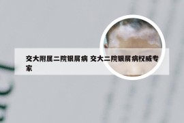 交大附属二院银屑病 交大二院银屑病权威专家